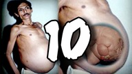 10 rzeczy, które wyrosły wewnątrz ludzi [TOPOWA DYCHA]
