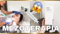 WSZYSTKO O MEZOTERAPII / VLOG