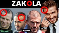 ZAKOLA  Fryzury Męskie i Sposoby Na ZAKOLA.  STOP na Wypadanie Włosów!