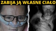 Zabija ją własne ciało! Pomóżmy Iwonie! Walka z czasem trwa! Akcja charytatywna Serce dla serca