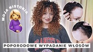 poporodowe wypadanie włosów  moja historia