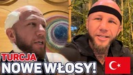 #24 Przeszczep włosów w Turcji (Istambuł) Pokaże wam jak to wygląda.  (Flymedica)