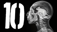 10 dziwnych rzeczy znalezionych w ludzkich ciałach [TOPOWA DYCHA]