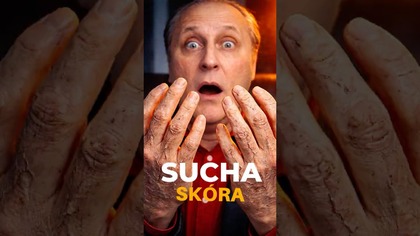 Sucha Skóra? Witaminy i Hormony to Nie Wszystko.