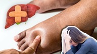 Jeśli masz jedną z tych objawów, NATYCHMIAST zacznij leczyć wątrobę!