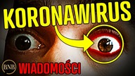 Naukowcy OSTRZEGAJĄ! Wirus przenosi się przez...  OCZY | WIADOMOŚCI