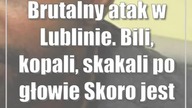 Brutalny atak w Lublinie.  Bili, kopali, skakali po głowie Skoro jest czarny...