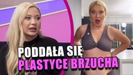 Lili Antoniak przed operacją plastyczną usłyszała, że musi SCHUDNĄĆ!