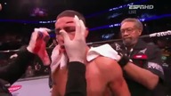 UFC - Krwawy sport