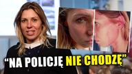 Zofia Klepacka: Zostałam pobita przez damskich bokserów.  Pokazała zdjęcia