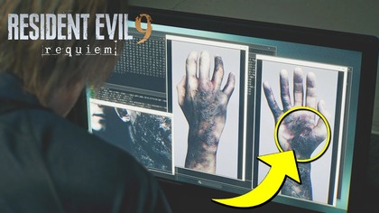 Tajemnica choroby Leona w RE Requiem - Syndrom Raccoon City