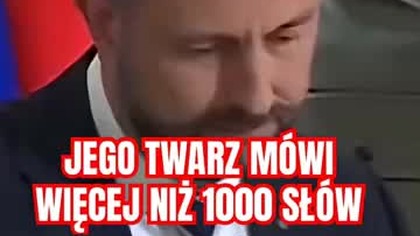 1370 JEGO TWARZ MÓWI WIĘCEJ NIŻ 1000 SŁÓW!!!!!!!!!!!!!!!! (1)