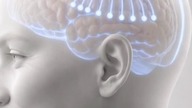 Pierwszy na świecie komercyjny implant mózgowy zatwierdzony.