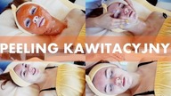 Mój pierwszy zabieg | peeling kawitacyjny, masaż twarzy + maseczka