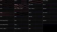 Eschatos - Area 12-15 Point of No Return [MegaDrive/Genesis limitless rearraged]