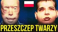 10 WIELKICH POLSKICH POSTEPOW W MEDYCYNIE