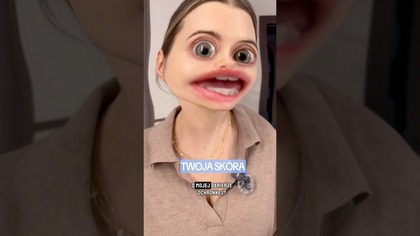 Moja skóra oficjalnie zagroziła mi wypowiedzeniem 
