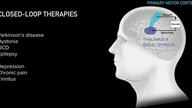 Neuralink Launch Event (ENG)