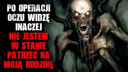 Po operacji oczu widzę inaczej.  Nie jestem w stanie patrzeć na moją rodzinę - CreepyPasta