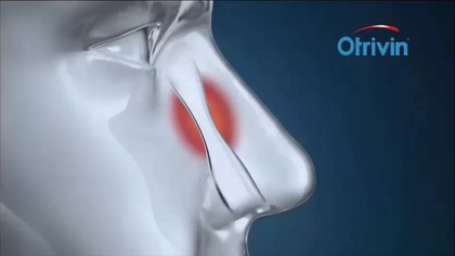 (REUPLOADED) Otrivin Reklama z 2014-2015 roku