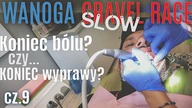  Borowanie u dentysty - okropny b&oacute;l zęba - cz .  9 - na Około