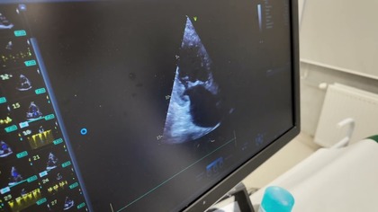 Pacjenci kardiologiczni skorzystają na KPO.  Szpital w Jaworznie zakupi nowoczesne urządzenia