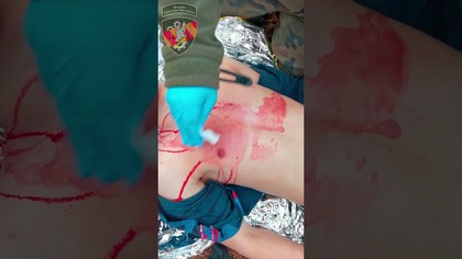  Opatrunek okluzyjny Chest Seal J+B Tactics | Sprzęt medycyny taktycznej  przegląd #chestseal