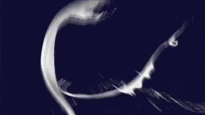 Przeglądarka - czoł&oacute;wka i tył&oacute;wka