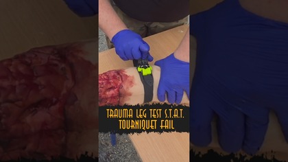  S. T. A. T.  OD STAT MEDICAL DEVICES  TEST NA TRAUMA LEG | HARD TEST