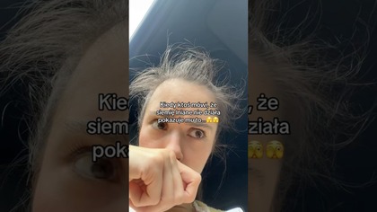 TANIE ROZWIĄZANIE NA BABY HAIR! / włosy rosną jak szalone!