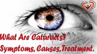 What Are Cataracts? Symptoms, Causes, Treatment.