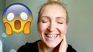BEDE NOSIC APARAT? MAM DLA WAS BUTY! | DLM
