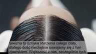 Domowe sposoby na siwe włosy - Skorzystaj z NATURALNYCH składników