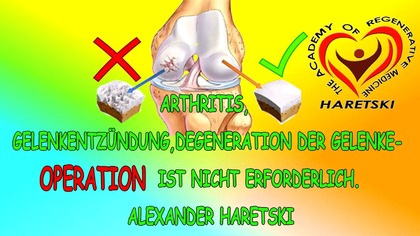 Arthritis, Gelenkentzündung, Degeneration Der Gelenke - Operation Ist Nicht Erforderlich.  Haretski.