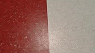 także zabronili mi nagrywać także było tylko w plecaku w szpitalu i tak za długo to trwało