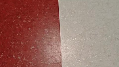 także zabronili mi nagrywać także było tylko w plecaku w szpitalu i tak za długo to trwało