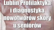 Lublin: Profilaktyka i diagnostyka nowotworów skóry u seniorów