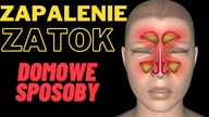 Problemy z ZATOKAMI - Te domowe sposoby szybko pomogą.  Zapamiętaj je!