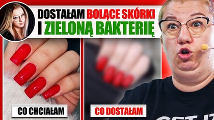 CHCIAŁA PIĘKNE PAZNOKCIE, A OTRZYMAŁA BÓL I ZIELONĄ BAKTERIĘ...  | Co chciałam, a co dostałam