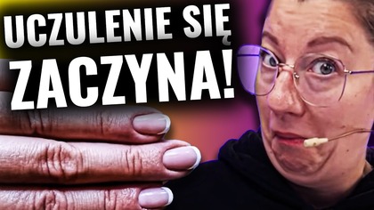  SWĘDZENIE, ROPA I OPUCHLIZNA MÓJ NAJGORSZY BŁĄD! 