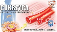 Co to jest Cukrzyca? Jakie Przyczyny? Jakie są Metody Uzdrawiania i Leczenia? Medycyna Regeneratywna