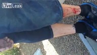 Konsekwencje wypadku motocyklem, gdy nie masz ochraniaczy