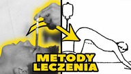 10 DZIWNYCH HISTORYCZNYCH METOD LECZENIA