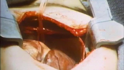 Oblicza śmierci Faces of Death (1978) - Film