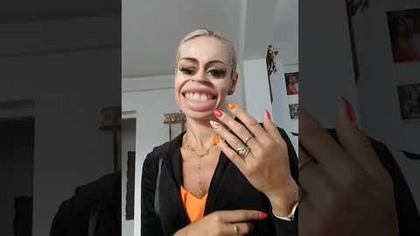 Bardzo bolało #uśmiechnijsię#humour#kabaret#parodia#