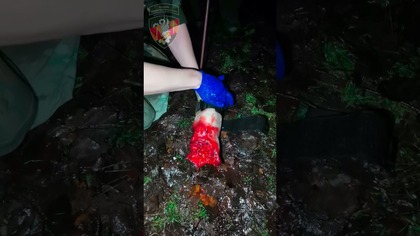  Staza taktyczna TMT TQ + Trauma Leg Long Range Solution | Medycyna taktyczna #TMTTQ #TCCC #TECC