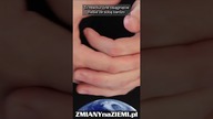 Implant mózgowy przywraca sparaliżowanemu mężczyźnie ruch i czucie