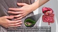 Pozbyła się kamieni żółciowych tymi domowymi sposobami