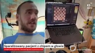 Sparaliżowany pacjent z chipem w głowie rozegrał partię szachów [Serwis informacyjny, KSTV Info]