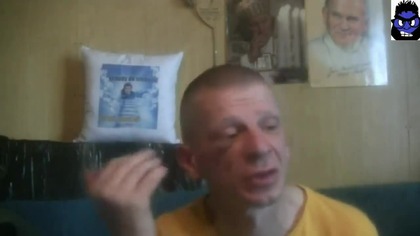 CZEMU MAJOR MA PODBITE OKO 19 cze 2021
